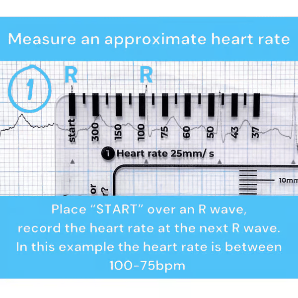Righello ECG 7 fasi
