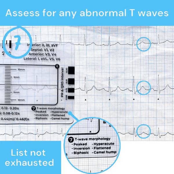 Righello ECG 7 fasi