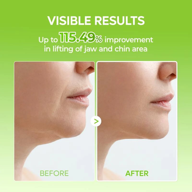 Fascia per V-Lifting e Mewing (4 maschere per confezione)