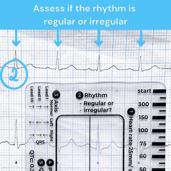 Righello ECG 7 fasi