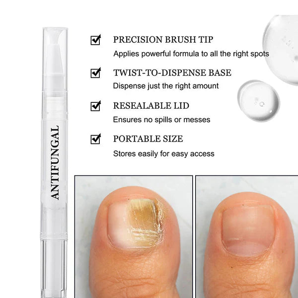 💅 ACQUISTA 1, OTTIENI 1 GRATIS! ✨ Penna per Trattamento di Micosi alle Unghie – Azione Rapida, Applicazione Precisa & Effetto Lenitivo 🦶