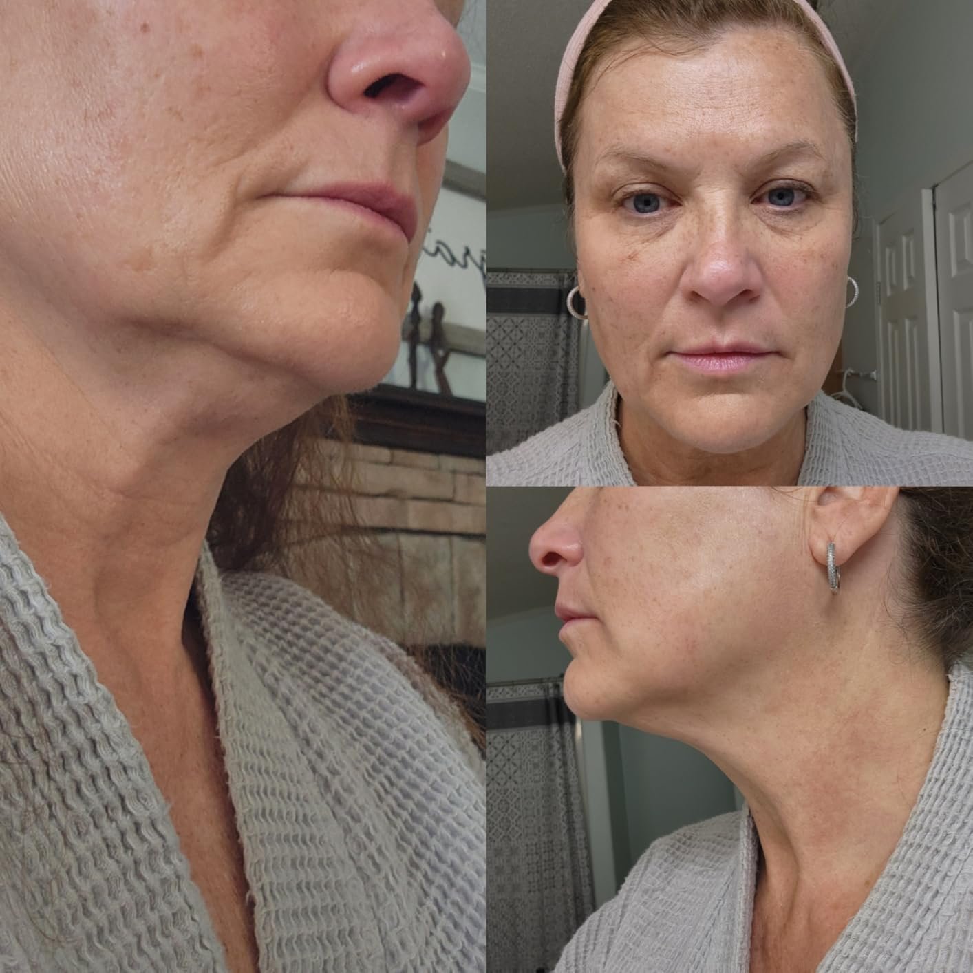 🎉Prendi due al prezzo di uno🎁 - Crema rassodante per il collo al collagene e fullerene