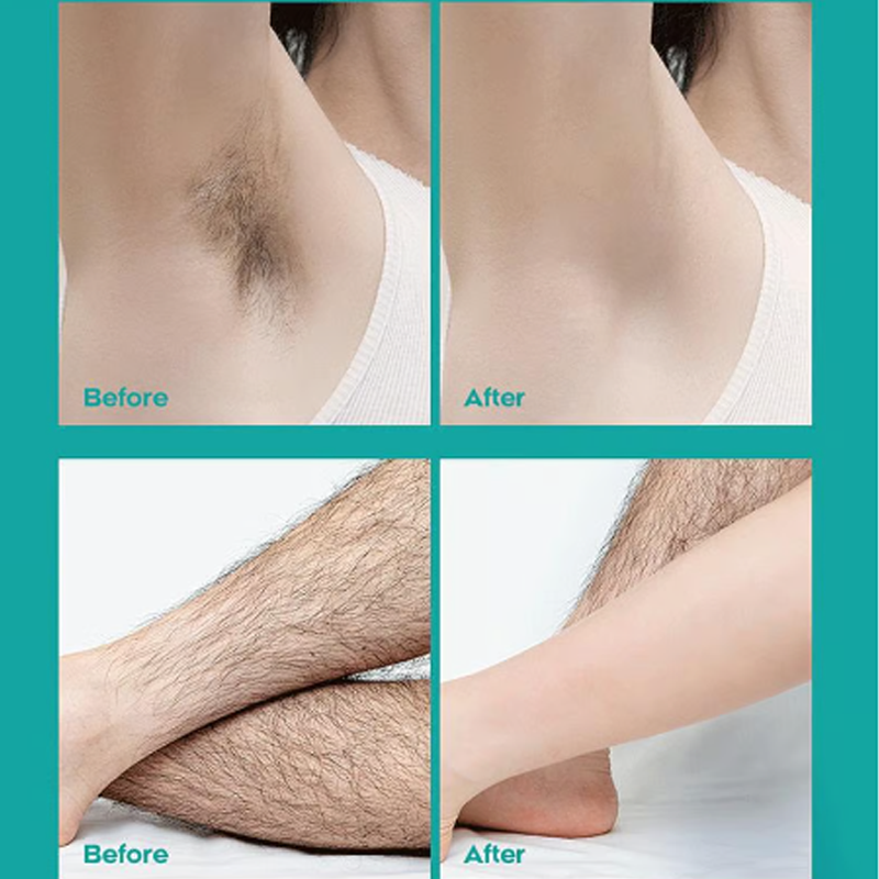 🔥Crema depilatoria indolore per tutto il corpo, per uomini e donne – Delicata sulla pelle, adatta a tutte le zone🌿