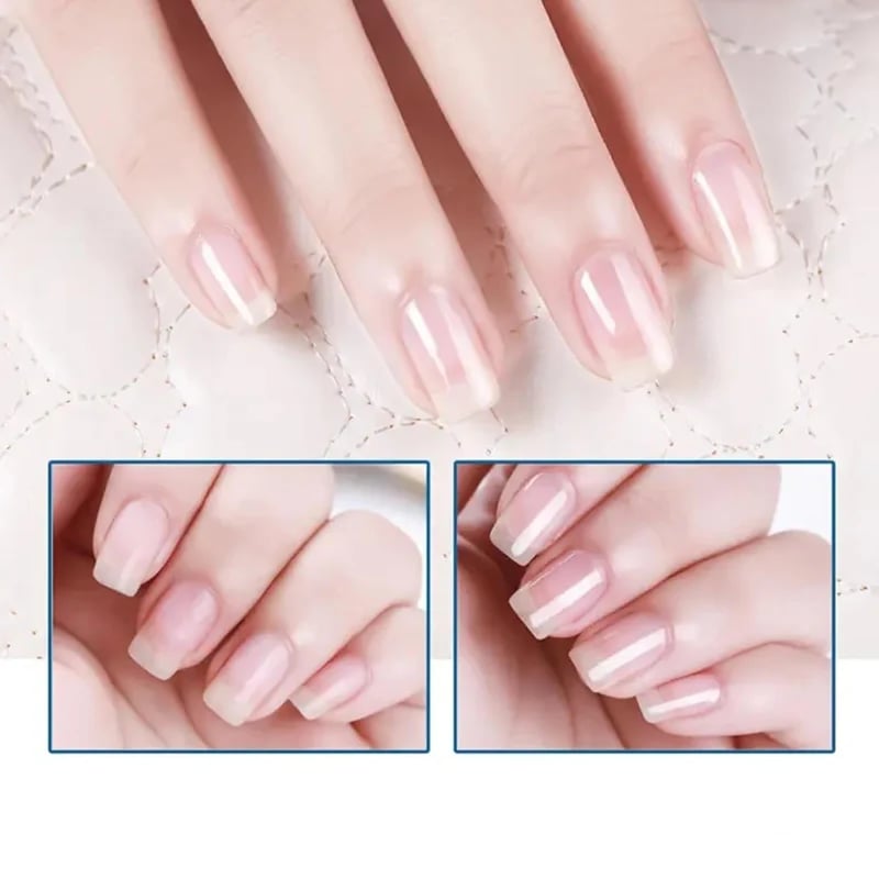 💕Formula per la cura delle unghie in 3 giorn