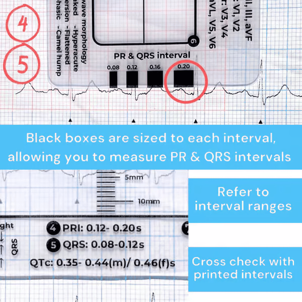 Righello ECG 7 fasi