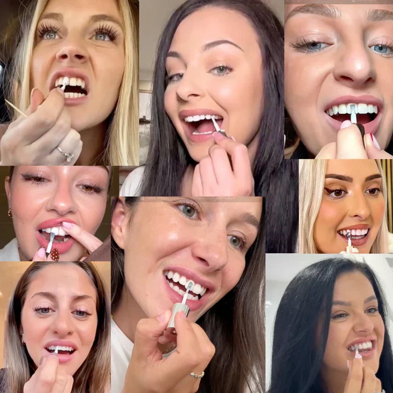 🦷Vernice sbiancante istantanea per denti da 5 ml – Effetto rapido, sicura per lo smalto e facile da applicare 💎